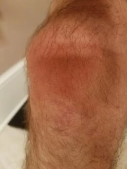 Incrediwear Knee Sleeve -Hiking And Camping 20180829 080443